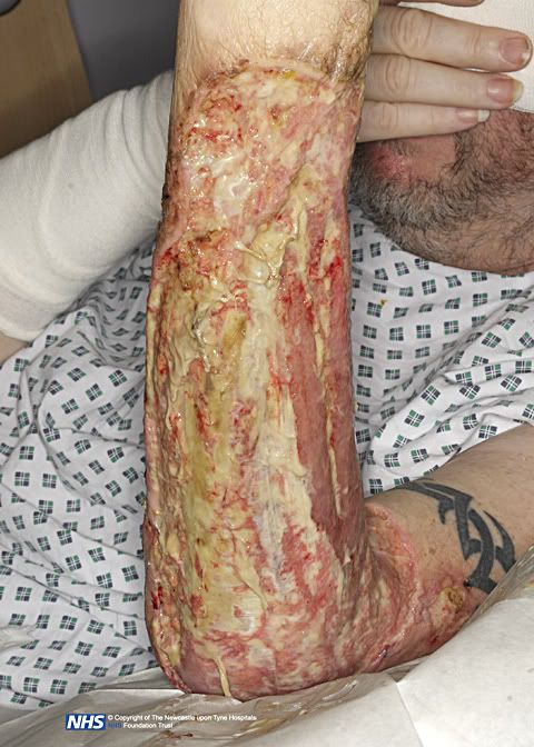 hospitalarmpics034.jpg