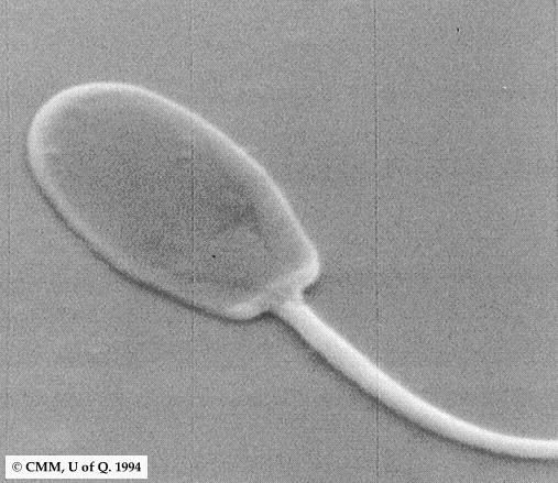 sperm1.jpg