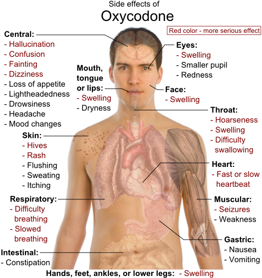 Oxycodone Side Effects - Rapid Detox.