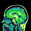 Psychedelic Brain