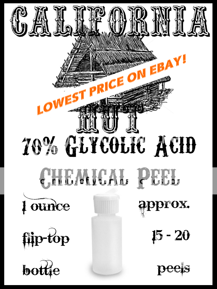 70% GLYCOLIC ACID Medical Grade Chemical Peel 1 oz  